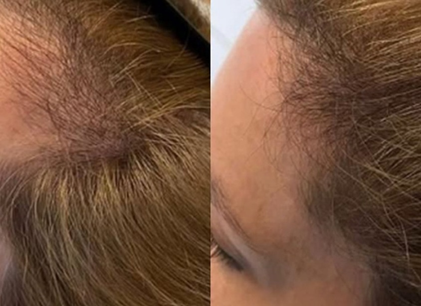 WhatsApp Image 2026-01-23 at 8.40.15 PM (6)_1600x700 (1)_844x614